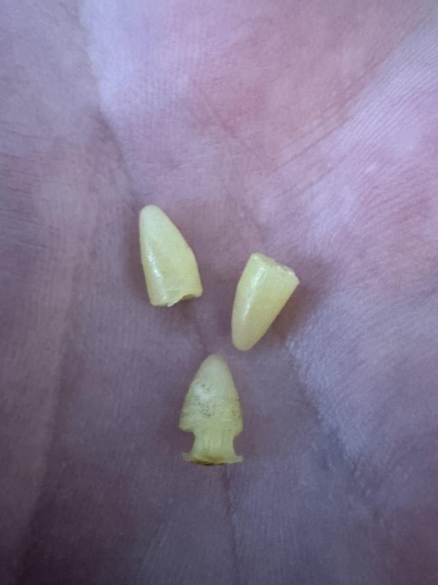 ​What are these small plastic cones I keep finding around my house?