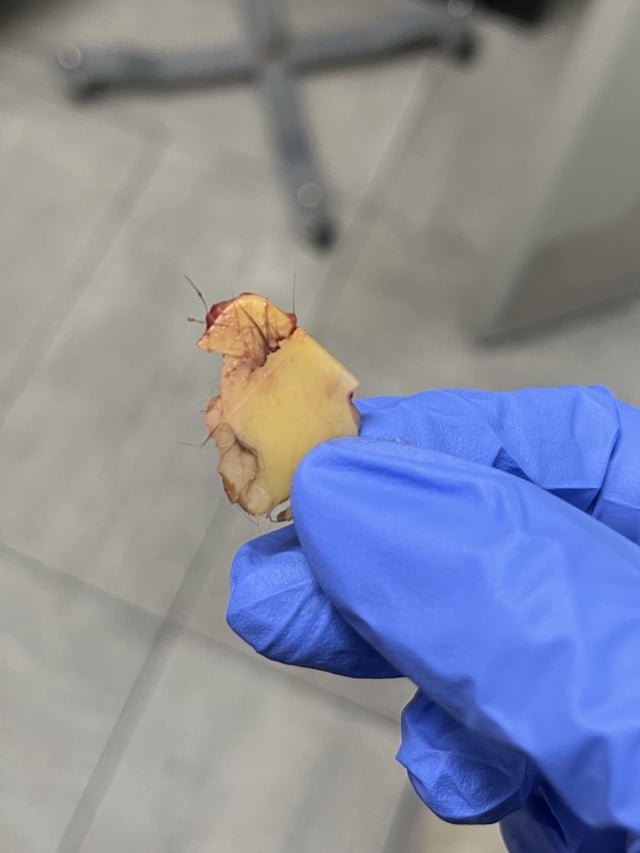 ​Piece of flexible rubber/silicone caused intestinal blockage in my cat, about the size of top of my thumb, looks like it’s from the corner of something